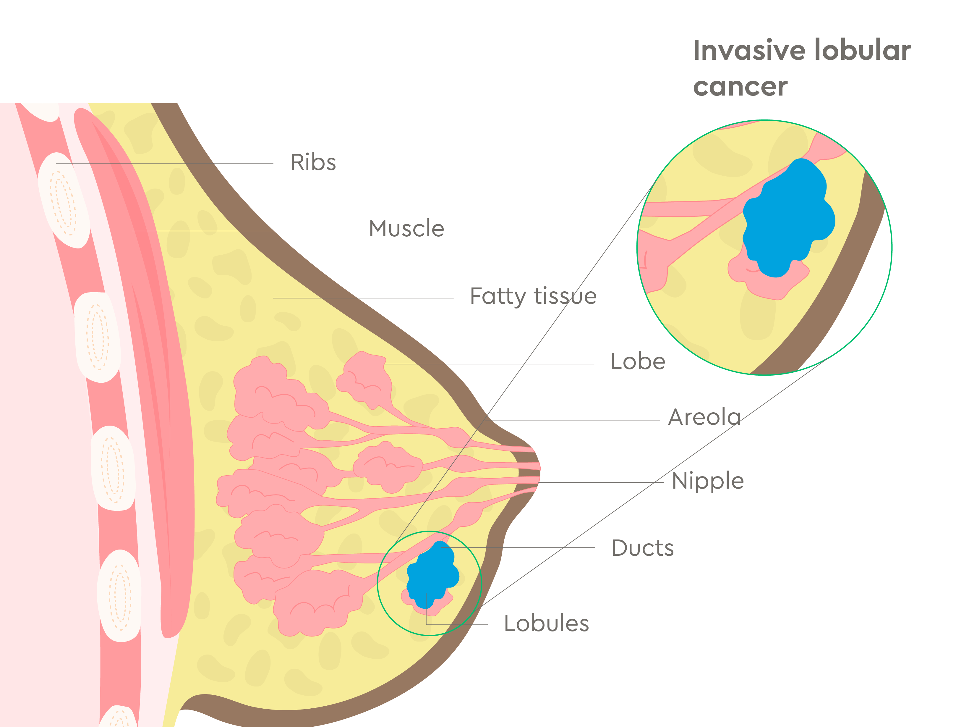 UK Oncology Geeta Prostate Cancer Treatment