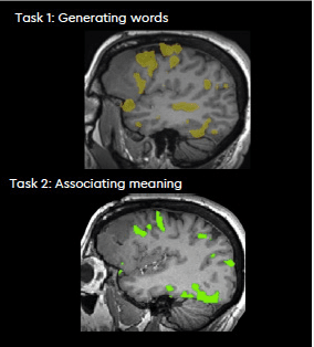 FMRI