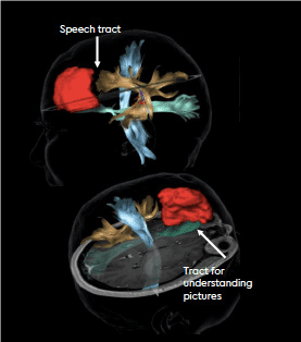 FMRI