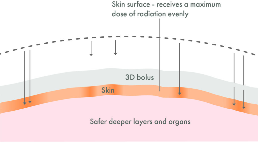 Skin layers