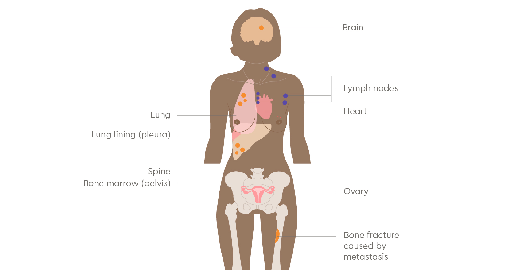 Breast illustrations | GenesisCare UK