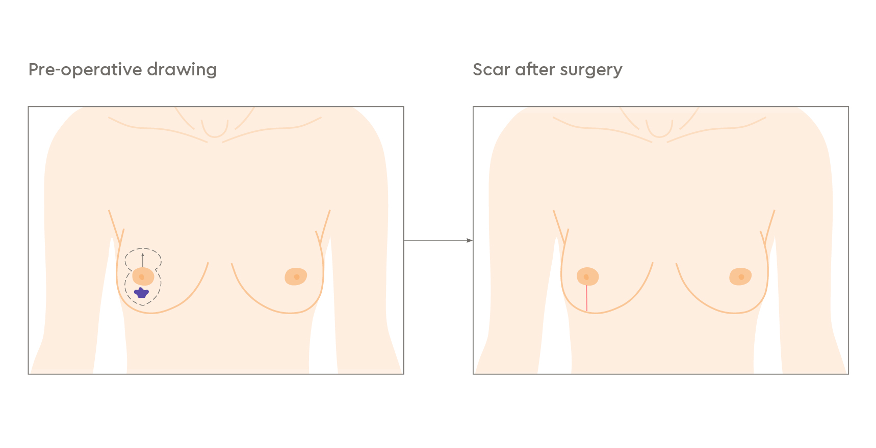 breast-anatomy-1