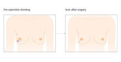 breast-anatomy-1